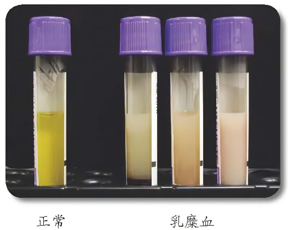 血漿質(zhì)量機器視覺分級——從“人眼比色”到“毫秒級